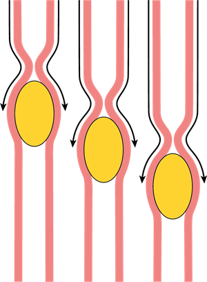 YCIND_221202_4782_gastrointestinal peristalsis.png