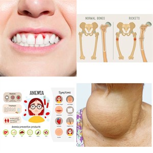 MixCollage-28-Jun-2026-03-05-PM-1261.jpg