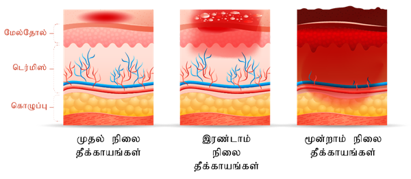 YCIND12052022_3800_Health and hygiene (TM) - 7th Part 2_3.png