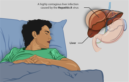 A_young_boy_suffering_from_Hepatitis-A.png
