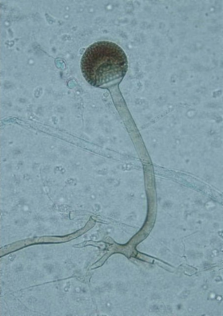 Rhizopus_microsporus.png