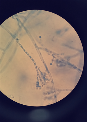 639px-Penicillium_notatum.png