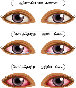 YCIND220610_3800_Health and hygiene (TM) - 7th Part 1_2.png