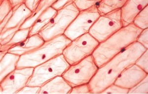 epidermalonioncellsundermicroscope260nw2206351289w300.jpg