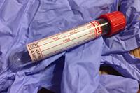 blood-1761832_1280.jpg