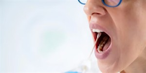 GeneticMethylationTestBuccalMouthSwabw300.jpg