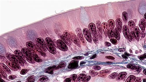 1200px-Epithelial_Tissues_Brush_Border_in_Simple_Columnar_Epithelium_(27854453998).jpg