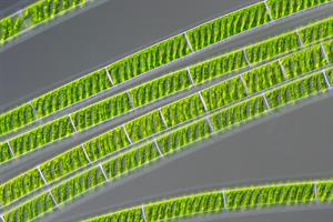 The_freshwater_alga_Spirogyra.jpg